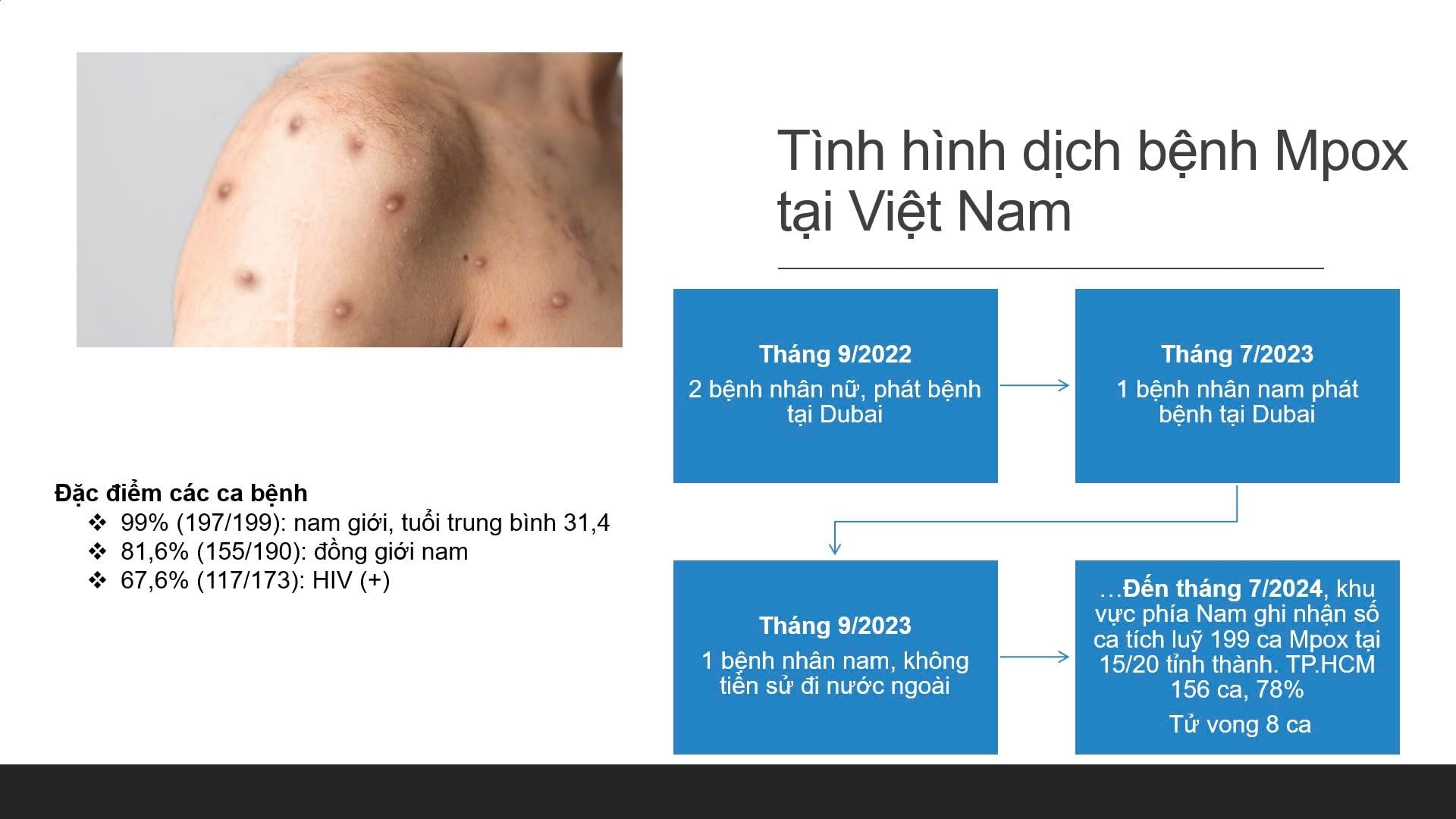 tinh-hinh-mpox.jpg