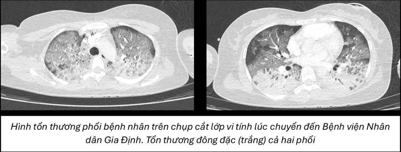 hinh-1-3-.jpg