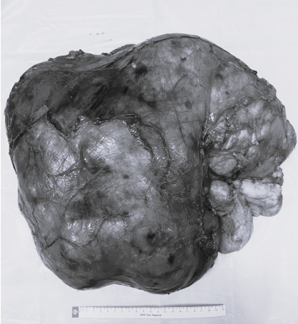 buou-mo-kich-thuoc-20x40x40cm_8kg.png