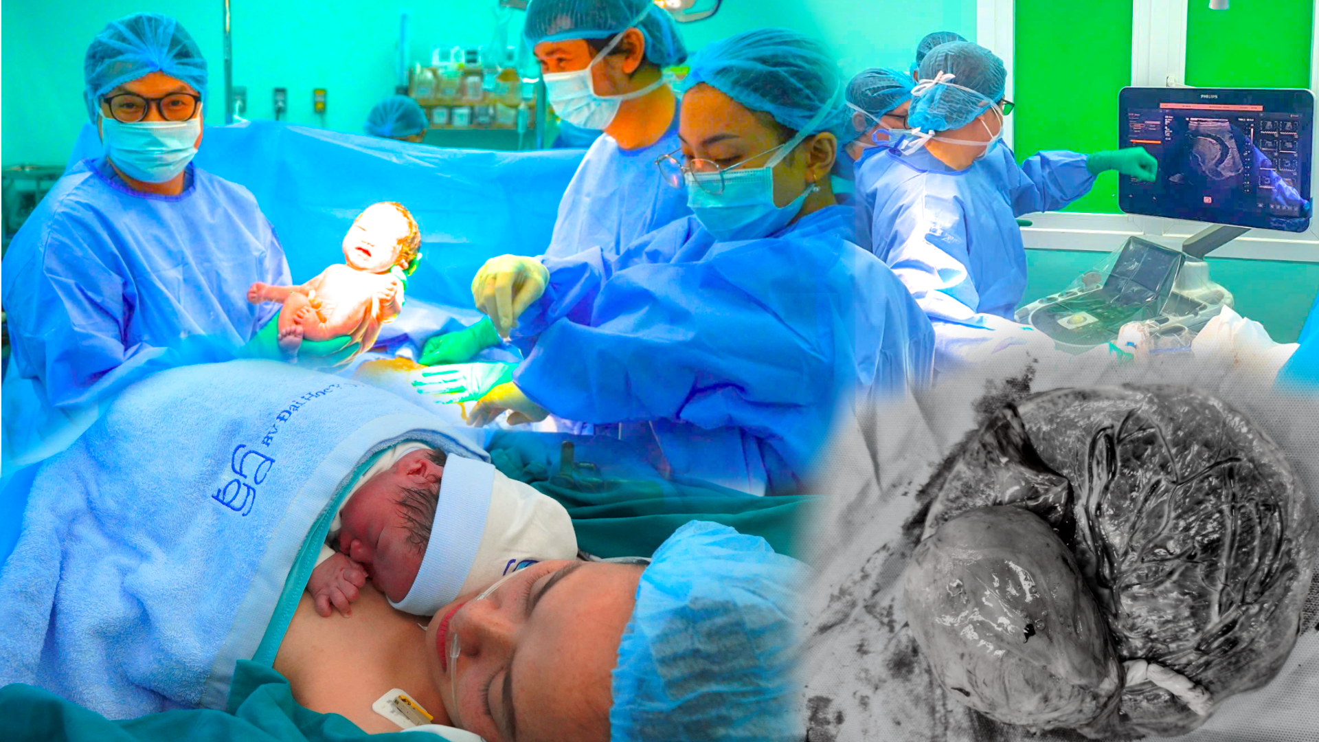 thanh-cong-cua-phoi-hop-da-chuyen-khoa-da-gop-phan-vao-su-phat-trien-y-hoc-bao-thai-viet-nam-1-.png