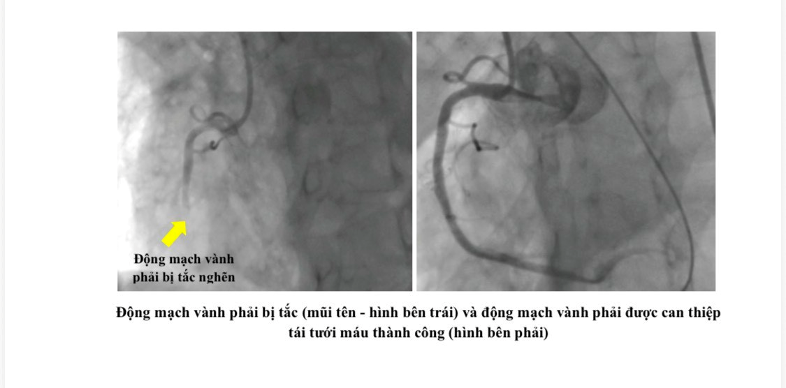 picture2(1).png