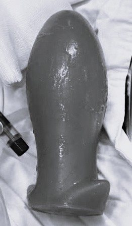 trung-rong-1.jpg