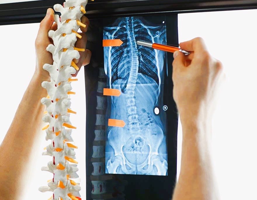 adult-scoliosis-treatment.jpg