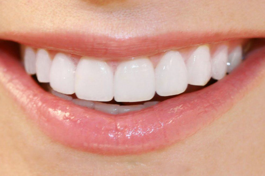 Bí quyết để có hàm răng đẹp, nụ cười xinh.