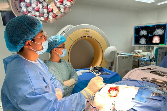 Lần đầu tiên tại Việt Nam, Bệnh viện Nguyễn Tri Phương cắt nửa bán cầu não điều trị động kinh kháng thuốc