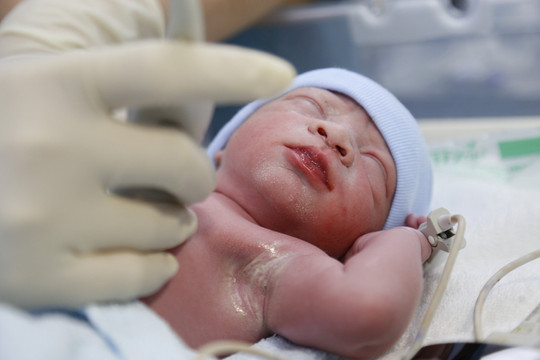 Bé trai được can thiệp tim trong bào thai đầu tiên chào đời khỏe mạnh