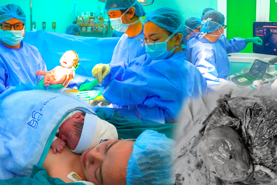 Thai nhi mắc khối u nhau thai khổng lồ được can thiệp thành công ngay trong bụng mẹ