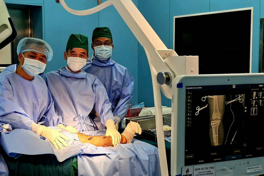 Bệnh nhân bị gãy xương chày được phẫu thuật thành công ngay tại Côn Đảo