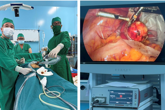 Thêm một trường hợp phẫu thuật nội soi thuộc lĩnh vực sản phụ khoa thành công tại Côn Đảo