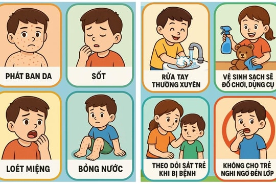 Sở Y tế TP.HCM cảnh báo tác nhân EV71 xuất hiện trở lại