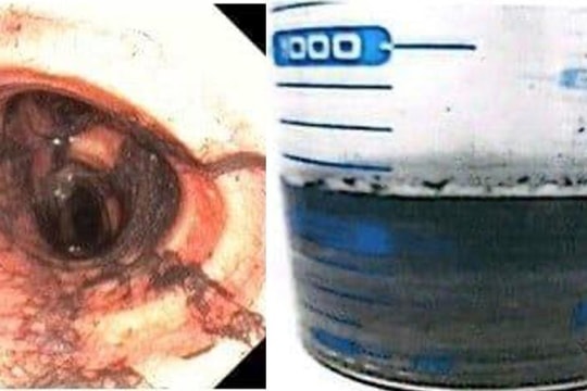 Phác đồ điều trị ngạt khói phát huy hiệu quả khi cứu người trong vụ cháy ở Tân Thới Hiệp