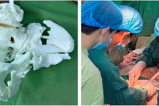 Bệnh viện Nhân dân 115 hỗ trợ Bệnh viện Đa khoa Bà Rịa phẫu thuật thành công 2 ca đa chấn thương nặng