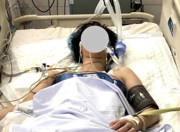 Nữ sinh 18 tuổi ngưng tim, ngưng thở được Bệnh viện Thống Nhất hồi sinh