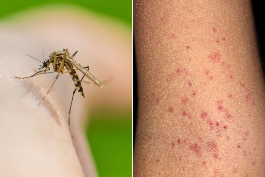 TP.HCM tăng cường phòng, chống bệnh sốt xuất huyết