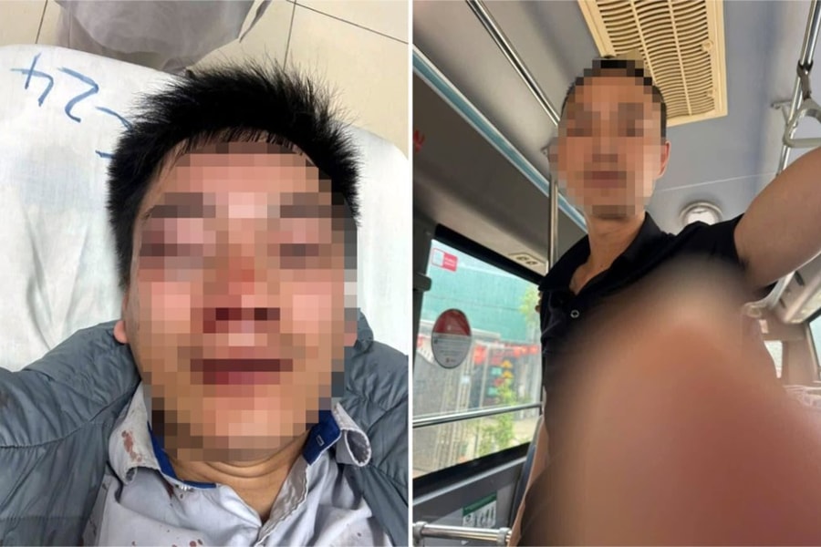 Va chạm khi xe buýt đang dừng đón trả khách, lái xe bị hành hung phải nhập viện...
