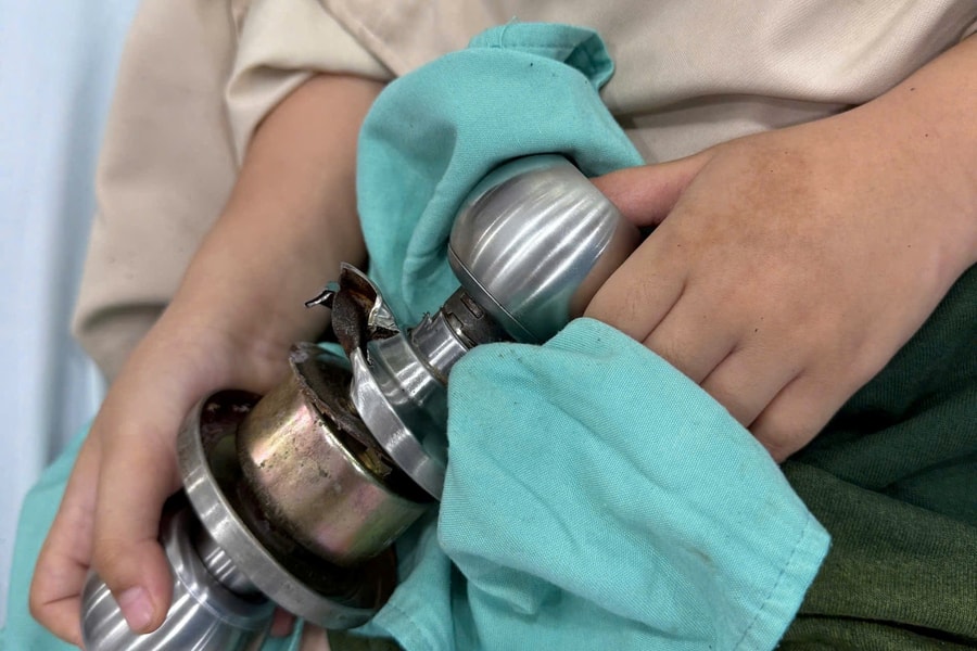 Bé trai 5 tuổi bị kẹt ngón cái vì đưa tay vào ổ khóa nhà