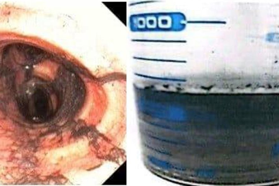 Phác đồ điều trị ngạt khói phát huy hiệu quả khi cứu người trong vụ cháy ở Tân Thới Hiệp