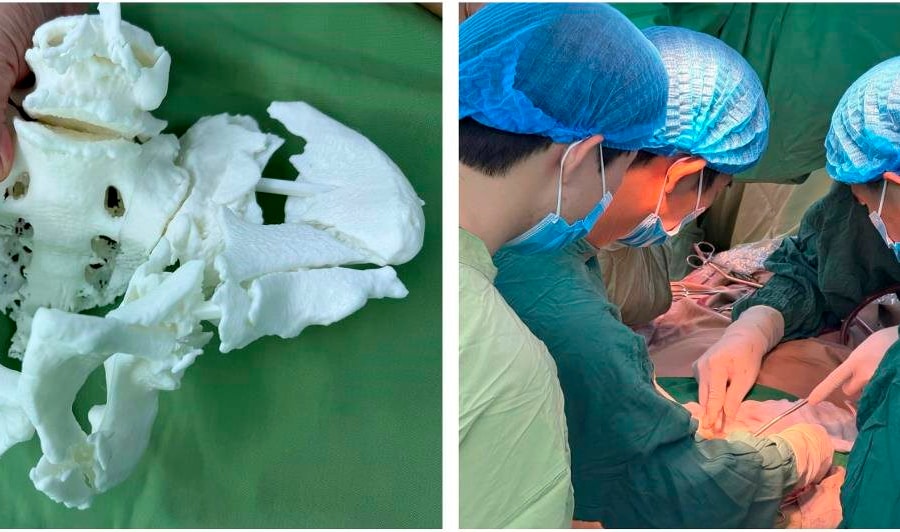 Bệnh viện Nhân dân 115 hỗ trợ Bệnh viện Đa khoa Bà Rịa phẫu thuật thành công 2 ca đa chấn thương nặng